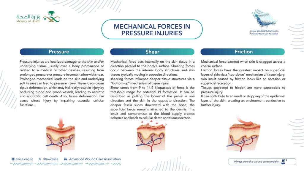 جمعية الرعاية المتقدمة للجروح Advanced Wound Care Association MECHANICAL FORCES IN PRESSURE INJURIES